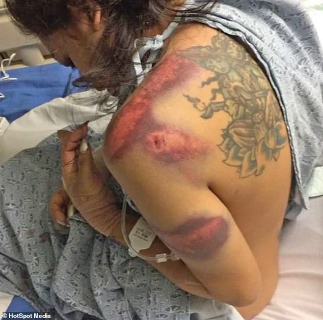 Survivor's Story Highlights Ongoing Challenges in Combating Human Trafficking