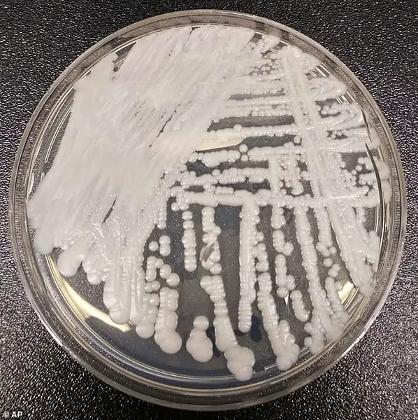 Deadly, Treatment-Resistant Fungus Spreading in Hospitals: CDC Warns of Escalating Public Health Crisis