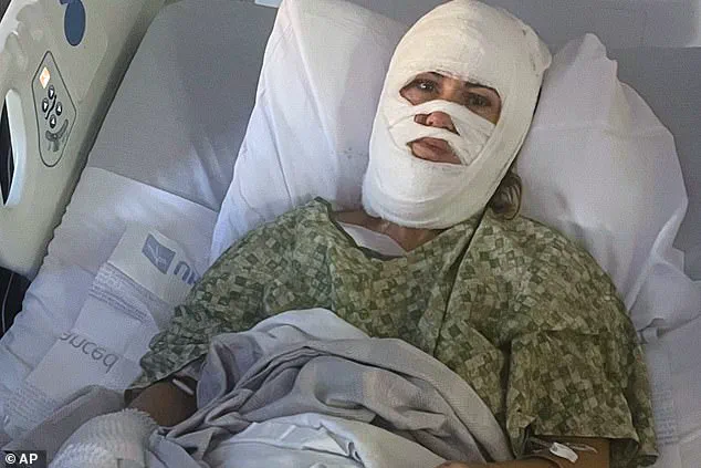 Random Acid Attack in Savannah Sparks Community Concerns Over Public Safety
