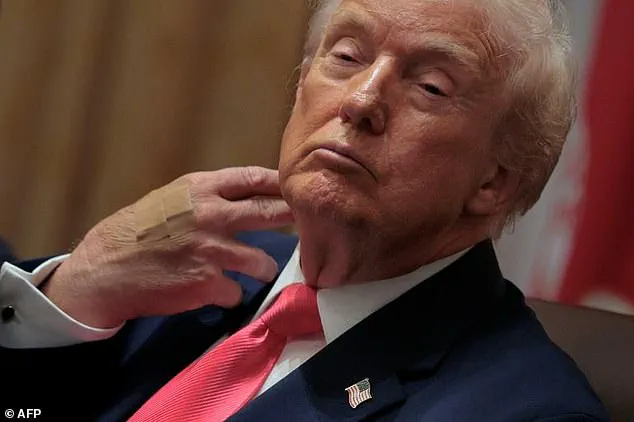 Health and Policy in the Spotlight: Analyzing Trump's Dietary Choices Amid Public Scrutiny