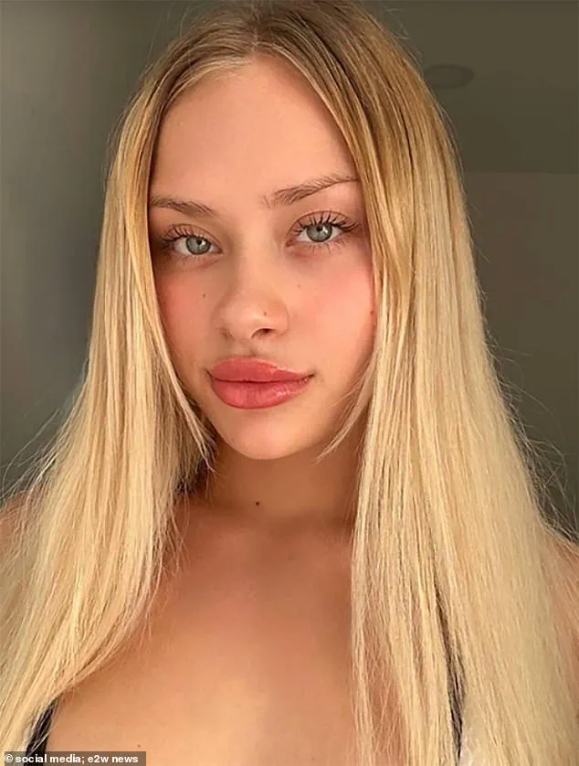 Ukrainian Woman Survives Catastrophic Injuries in Dubai, Takes First Steps After Coma