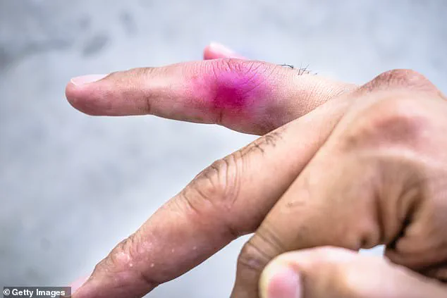 Unusual Lawsuit Between Minors Over Toy Dinosaur Incident at Daycare