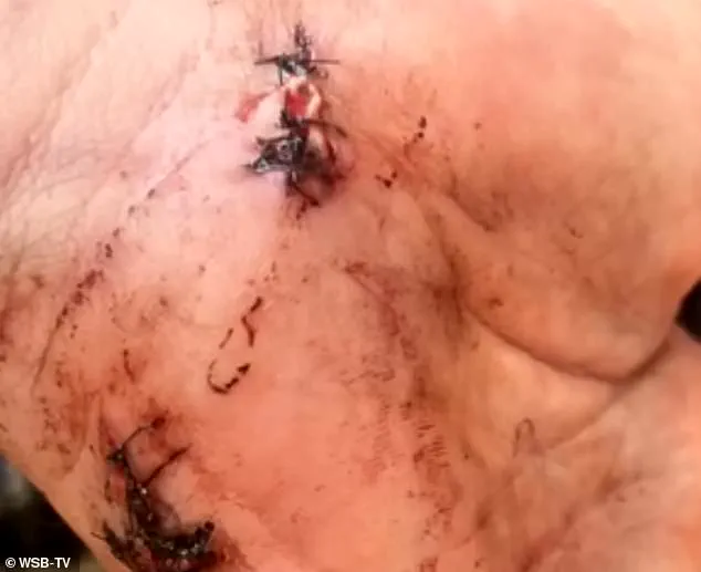 Wedding Day Tragedy Turns Legal Battle: Aaron White's Killing of Kailagh's Stepfather Sparks Community Division