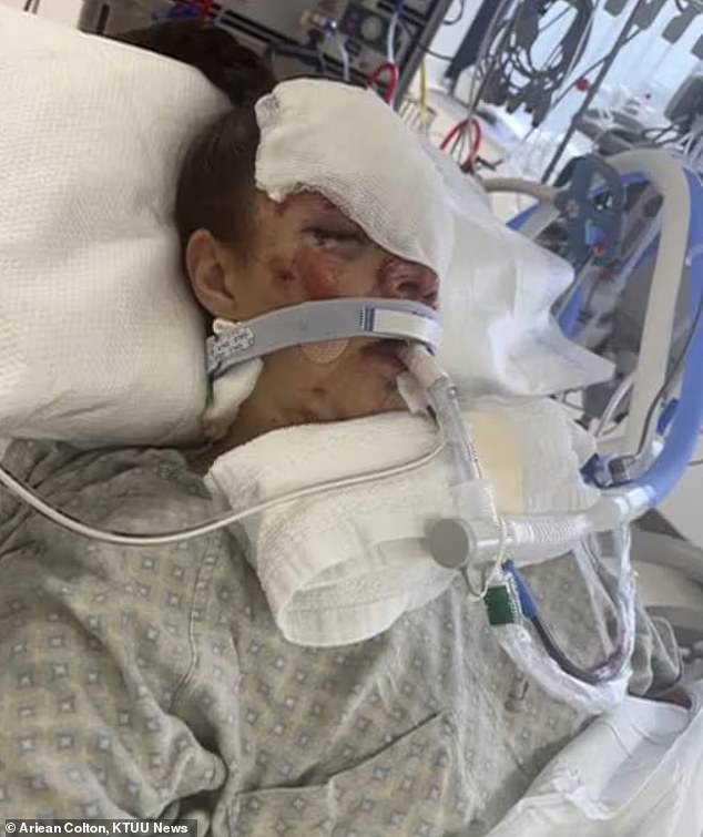 Kenai mother reveals full extent of bear attack injuries eight months later