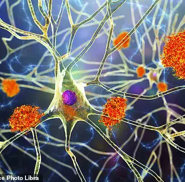 Scientists Develop Revolutionary Cell Therapy to Combat Alzheimer's Disease