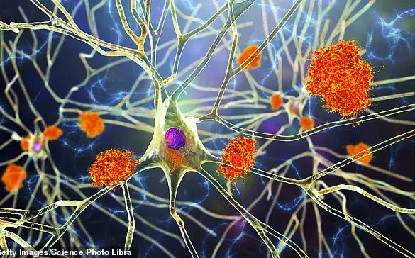 Scientists Develop Revolutionary Cell Therapy to Combat Alzheimer's Disease