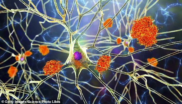 Scientists Develop Revolutionary Cell Therapy to Combat Alzheimer's Disease