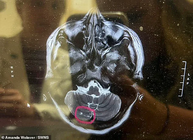 Breaking: Routine Botox Procedure Spirals into £22,000 Medical Crisis, Leaving Mother of Three Bedridden