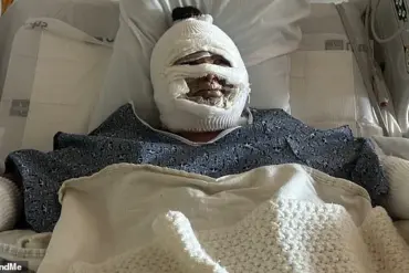 Urgent Alert: Hidden Dangers of Tabletop Fire Pits Expose Severe Risks After Teen Suffers Burns in Laguna Niguel