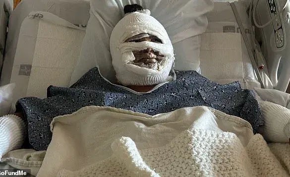 Urgent Alert: Hidden Dangers of Tabletop Fire Pits Expose Severe Risks After Teen Suffers Burns in Laguna Niguel