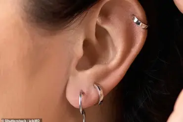 Exclusive Insights: The Dermatologist's Privileged Tip for Preventing Sagging Earlobes