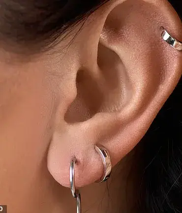 Exclusive Insights: The Dermatologist's Privileged Tip for Preventing Sagging Earlobes