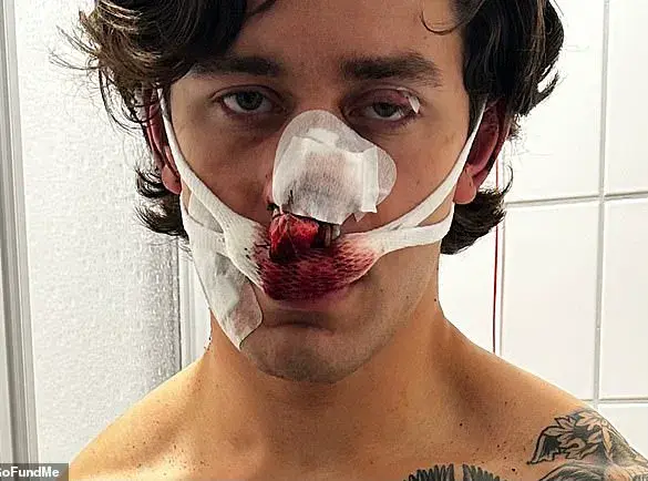 Late-Breaking: Dresden Subway Attack Leaves American Model Questioning System's Failure to Protect