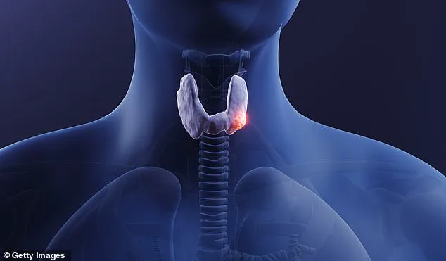 Years of Misdiagnosis: Tameika McBride's Thyroid Cancer Journey